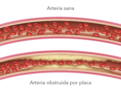 Doenças cardiovasculares comuns e riscos adicionais - Cuidando do Seu ...